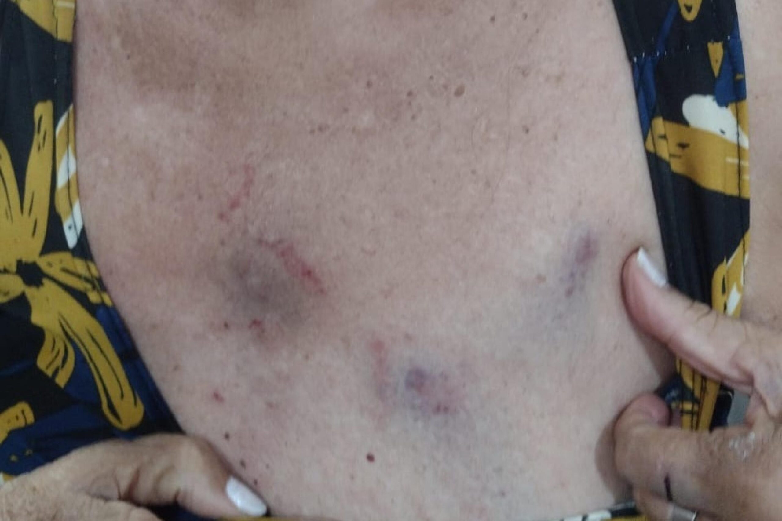 Médica é denunciada pelo MP em Arapiraca por agredir idosa de 77 anos com ajuda da filha adolescente